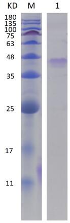 15% SDS-PAGE analysis profiles of purified PA1874-1544-2000 (CBB stained).